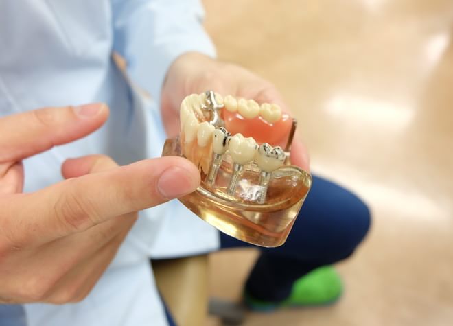 骨と結合しやすいインプラントを使用し、一回の手術で歯を補います