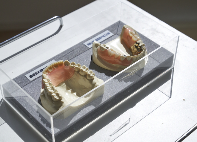 しっかりと噛む機能を取り戻すこと、残っている歯を守ることを意識して作製します