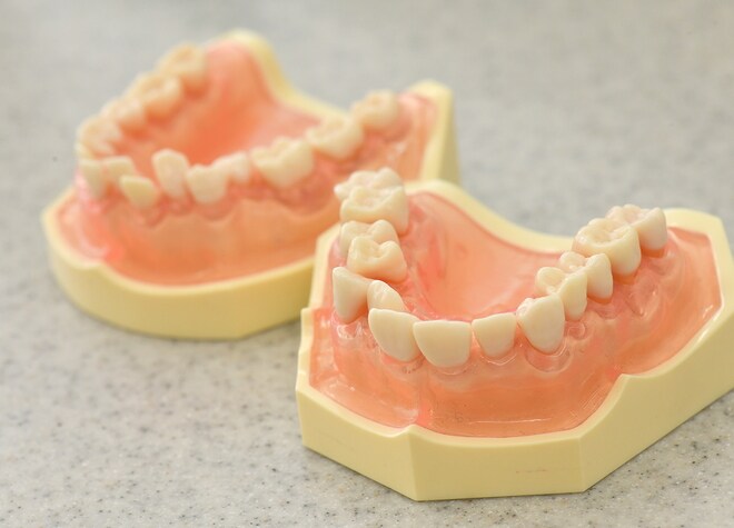 初めての診療の際には噛み合わせもしっかりチェックします