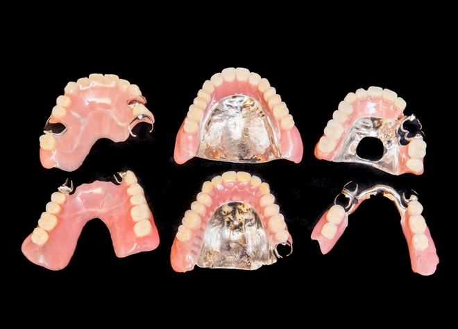 さまざまな入れ歯に対応し、歯とお口元全体のバランスを整えます