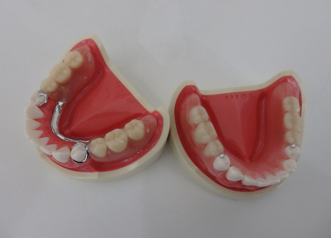Q.入れ歯の作製で大切にしていることは何ですか？
