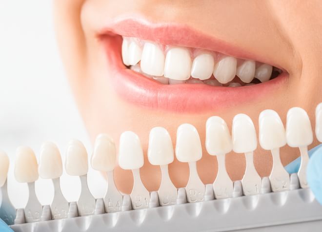三種類のホワイトニングプランで、白くて綺麗な歯で日々のモチベーションを上げましょう