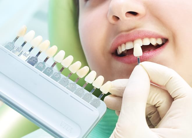 朝倉歯科医院のホワイトニングを希望される方はカウンセリングを充分に行って「自然で美しい笑顔のための魅力的な歯」を提案しています。