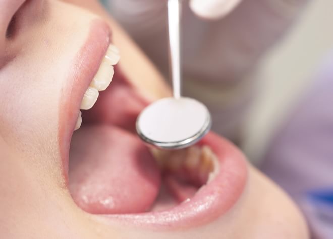 口内が乾いている状態のドライマウス（口腔乾燥症）は放置禁物。ご自身の口腔内・お身体に合った治療をご提供いたします