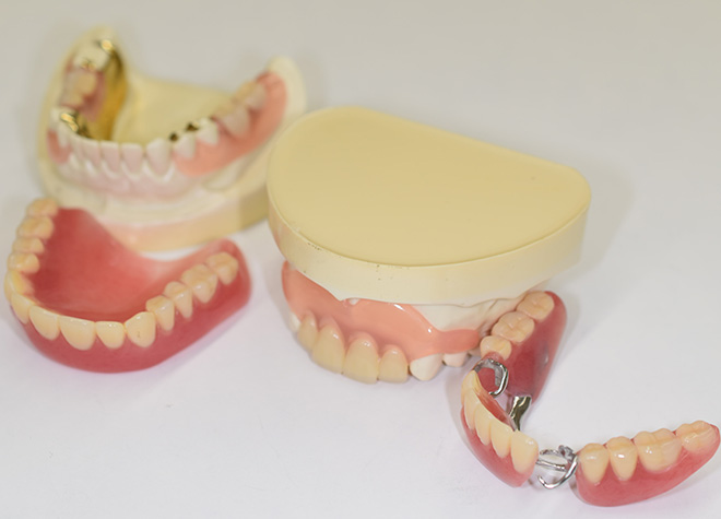 Q.違和感のない入れ歯を作るために重視していることは何ですか？