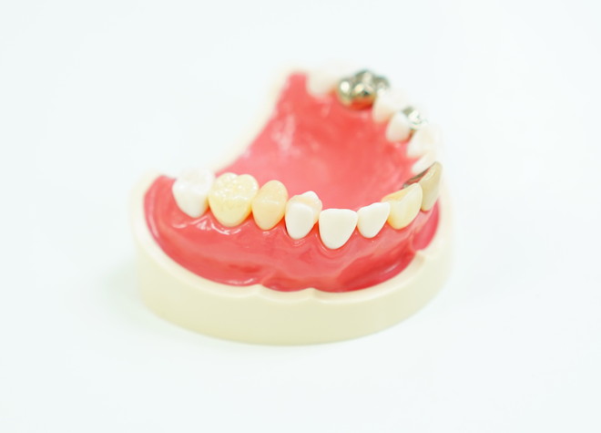 入れ歯は患者様ごとに丁寧にお作りいたします