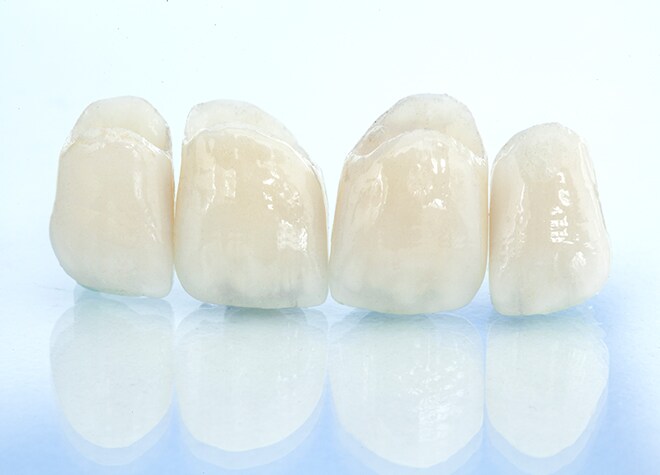 保険診療だけでなく、自由診療のつめ物・かぶせ物も取り扱っています