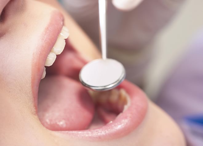 虫歯治療について、どのような説明をしていますか？
