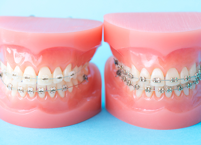 歯並びを改善することで、虫歯や歯周病の予防にも繋がります