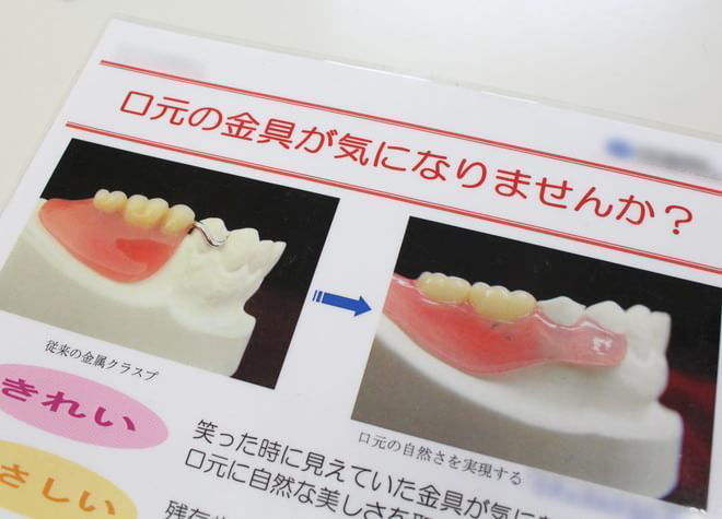 Q.患者さまに合う入れ歯を作るために気を付けていることはありますか？
