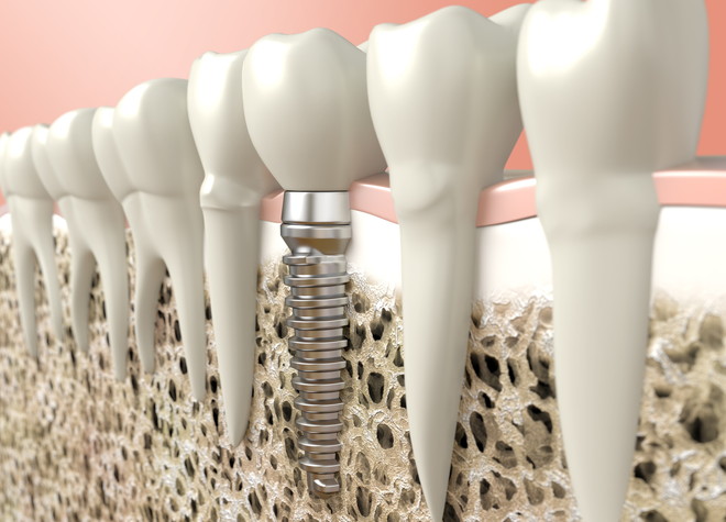 歯の欠損について深く考えながら、不安の少ない治療環境で施術いたします