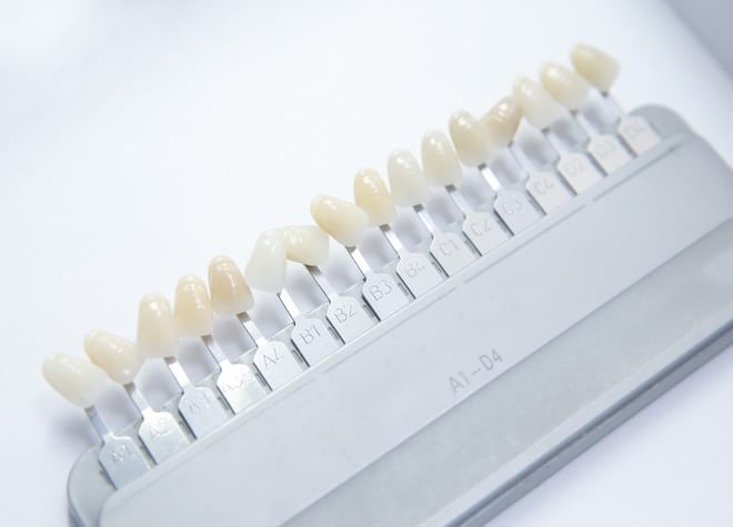 歯の状態を見極めて、ホワイトニング方法を提案します