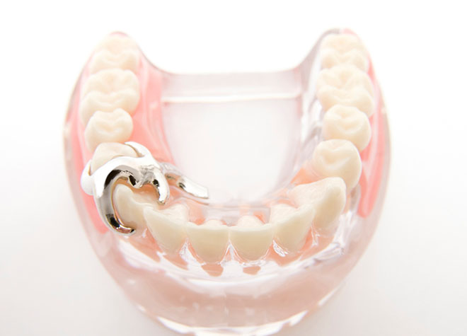 保険内で患者さまのお口に合わせた「噛める入れ歯」「使いやすい入れ歯」を作製できるよう努めております。