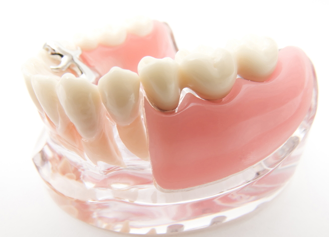 作製するにあたり、入れ歯の特性についてしっかりと説明することを大切にしています。