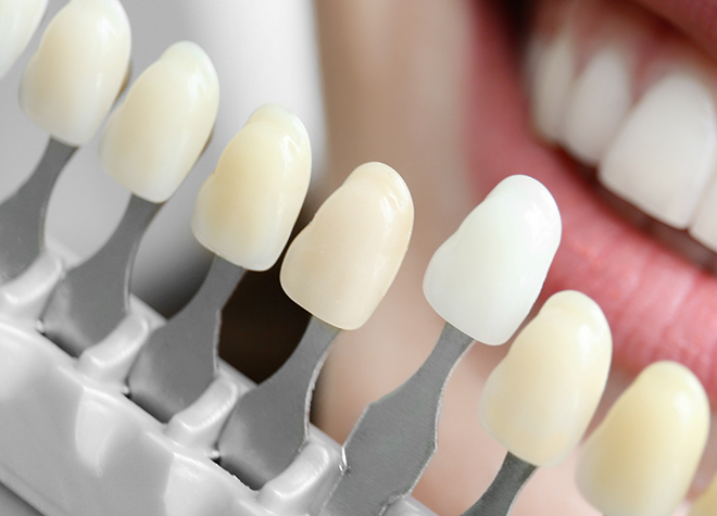 自然な白い歯を手に入れるために、ホワイトニングを始めませんか？