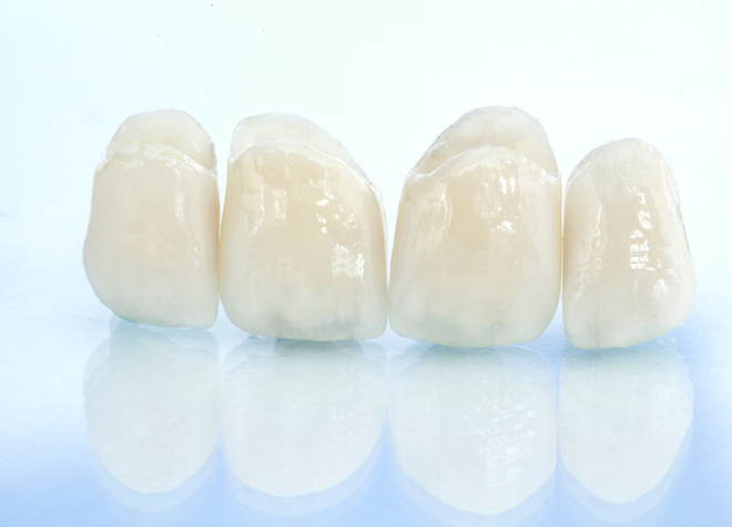 歯を白く仕上げるセラミック治療