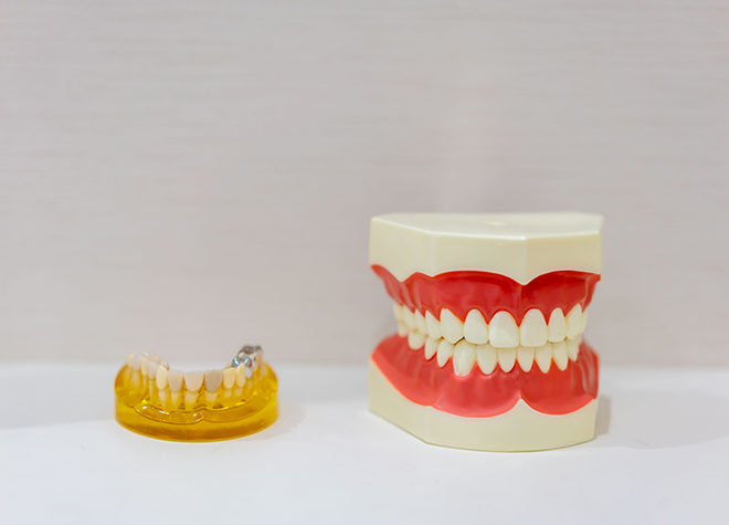 患者さまの歯の状態にマッチした素材を選んでいきます