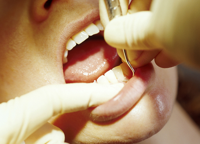 虫歯の治療を行う際に心がけていることはありますか？