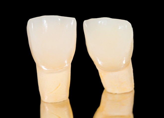 セラミック治療は汚れが付きにくく、再度虫歯になるリスクを低減させます