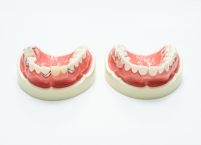 Q.入れ歯でおすすめの素材はありますか？