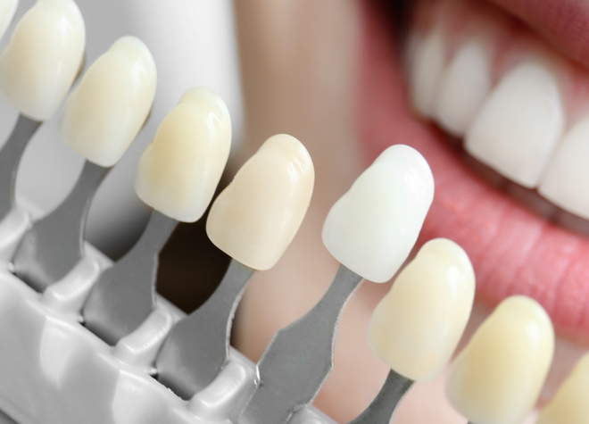 歯の着色や黄ばみが気になるという方は、ホワイトニングを検討されてはいかがでしょうか