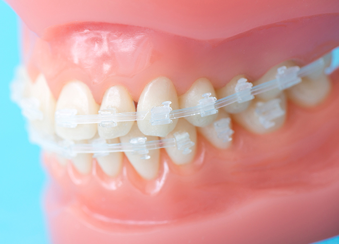 Q.入れ歯を作る前のヒアリングを重視するのはなぜですか？