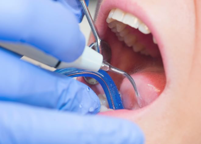 歯が残せなくなった場合に、ご自身の親知らずを移植する治療に対応しています