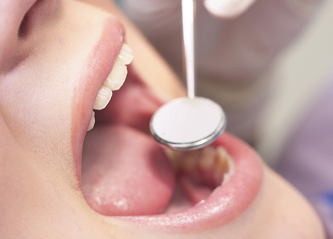 歯科検診は、なぜ大切だと言われているのでしょうか？