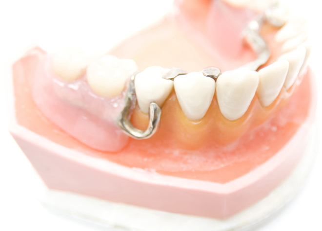 患者さまのお口に合った痛みが少ない入れ歯を作製します