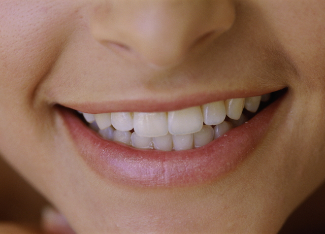 歯石やステイン除去の予防歯科にも力を入れています