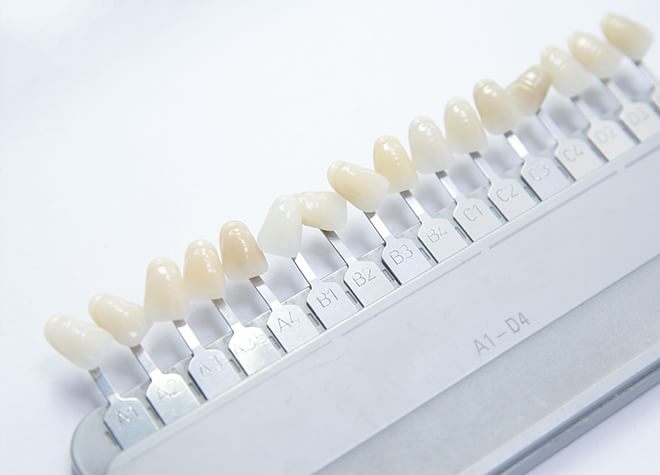 歯をより白くして笑顔で過ごすための方法として、ホワイトニングという選択肢があります