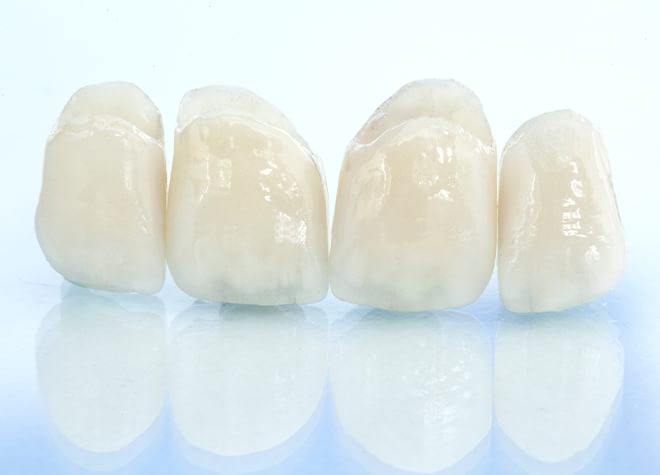 かぶせ物にセラミックを用いると、本物の歯との区別がつきづらくなります