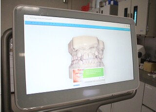 デジタル印象採得装置を導入しています。スキャナーをお口の中で添わせるだけで3Dシミュレーションによって型を採ることができます。