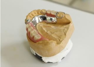 松野歯科医院 入れ歯・義歯