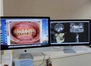 コンピューターを設置しています。