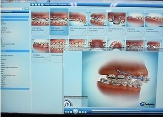 みつばやし歯科・矯正歯科クリニックは矯正治療にこだわりを持っています。