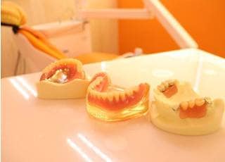 入れ歯の模型です。保険診療と自由診療の素材をそれぞれご覧いただけます。