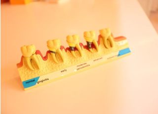 歯周病進行具合の模型です。