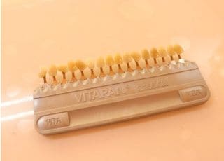 ホワイトニングの際にご覧いただく色見本です。