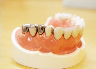 ともえ歯科 つめ物・かぶせ物