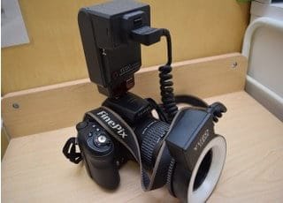 口腔内カメラです。治療前と治療後をお撮りすることで、治療経過を見ていただくことができます。