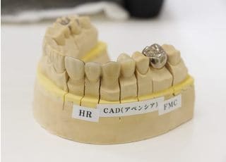 永冨歯科クリニック つめ物・かぶせ物