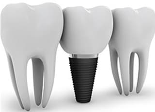 斉藤歯科クリニック_インタビュー4