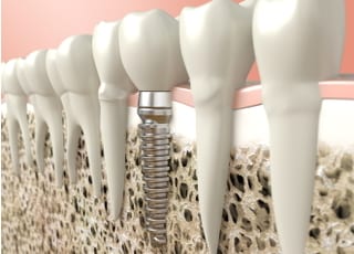 香川歯科医院_インタビュー1