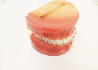 矯正治療の説明時に使用します。