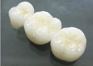仙北坂歯科クリニック つめ物・かぶせ物