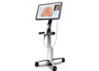 口腔内スキャナーを導入しています。お口の状態を詳しくお調べします。