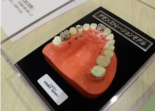 模型を使って治療の説明を行います。