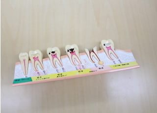 カノミ歯科医院(大津区) 歯周病