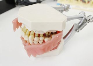 歯の模型を用いてご説明を行います。